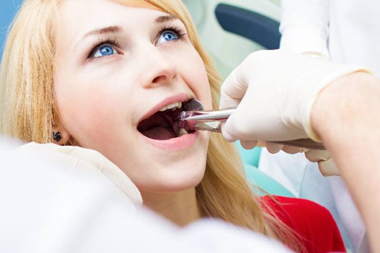 dental extraction
